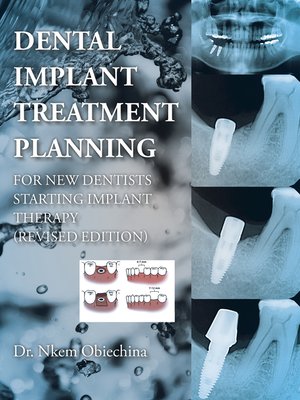 cover image of Dental Implant Treatment Planning for New Dentists Starting Implant Therapy